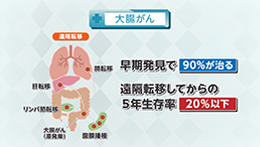 知りたい！がん検診（5/3）